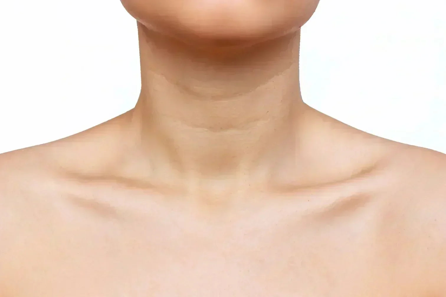 Age Gracefully: How to Manage Neck Wrinkles and Achieve Radiant Skin