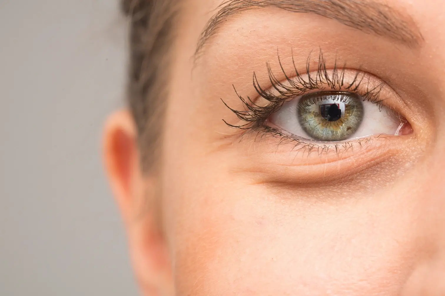 Understanding the Relationship Between Sleep and Under-Eye Bags