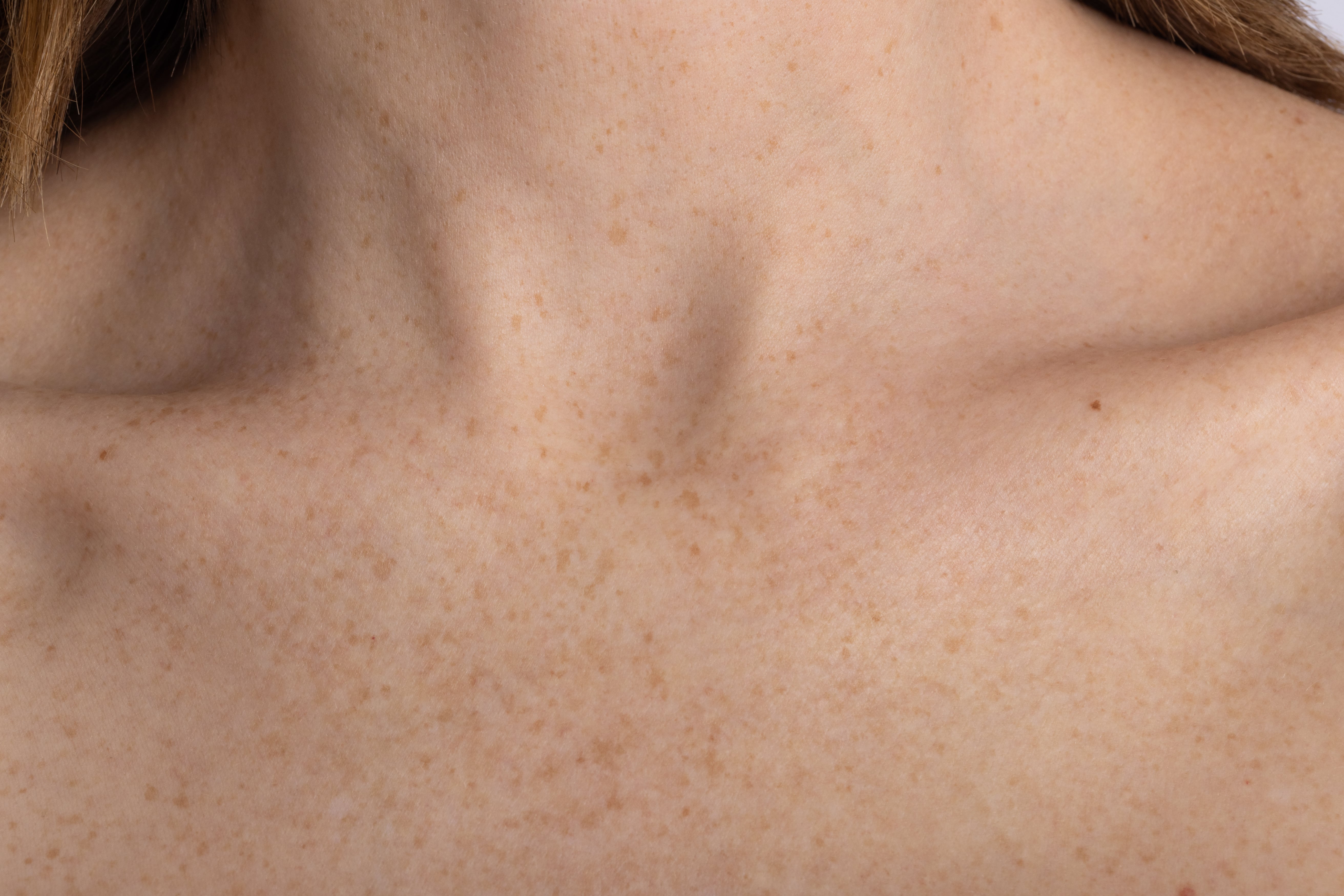 OneSkin