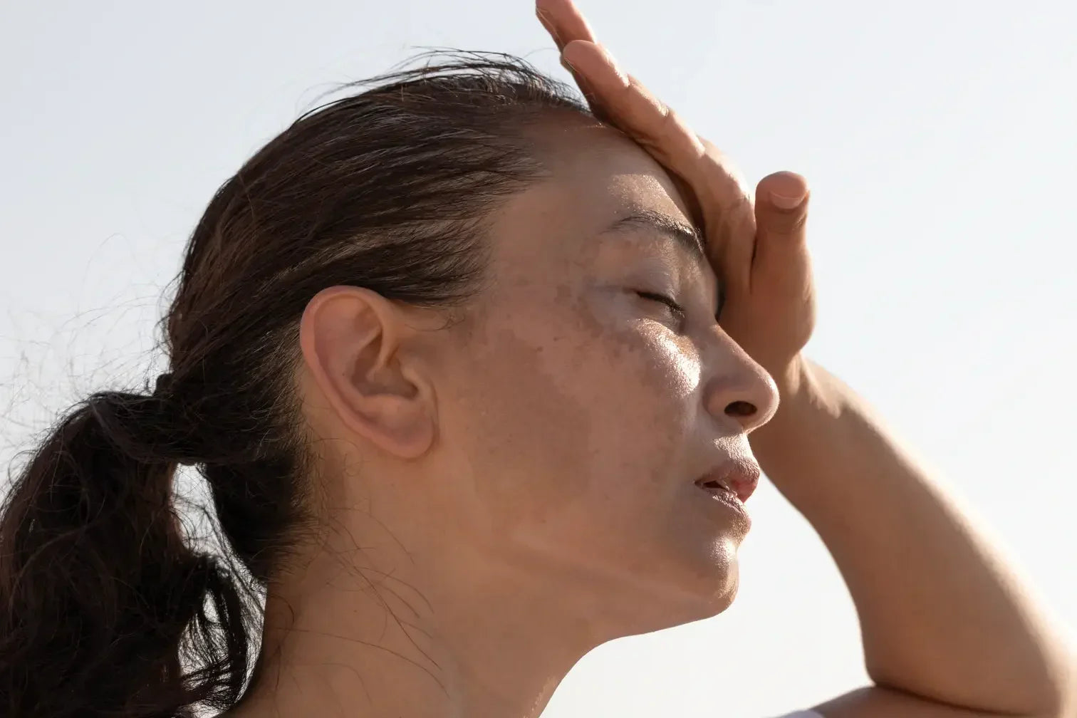 Hyperpigmentation and Menopause: Understanding and Treating Age Spots