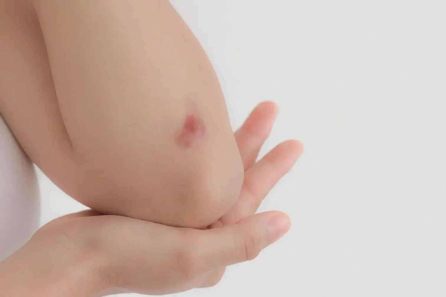 6 Factors That Contribute to Slow Skin Healing