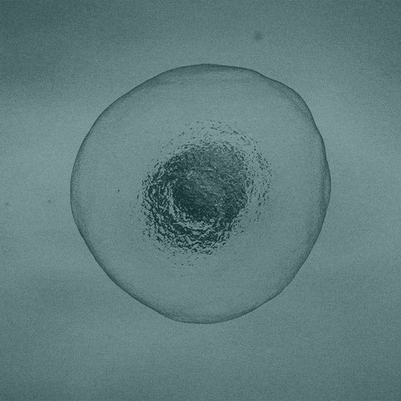 Cells multiplying 