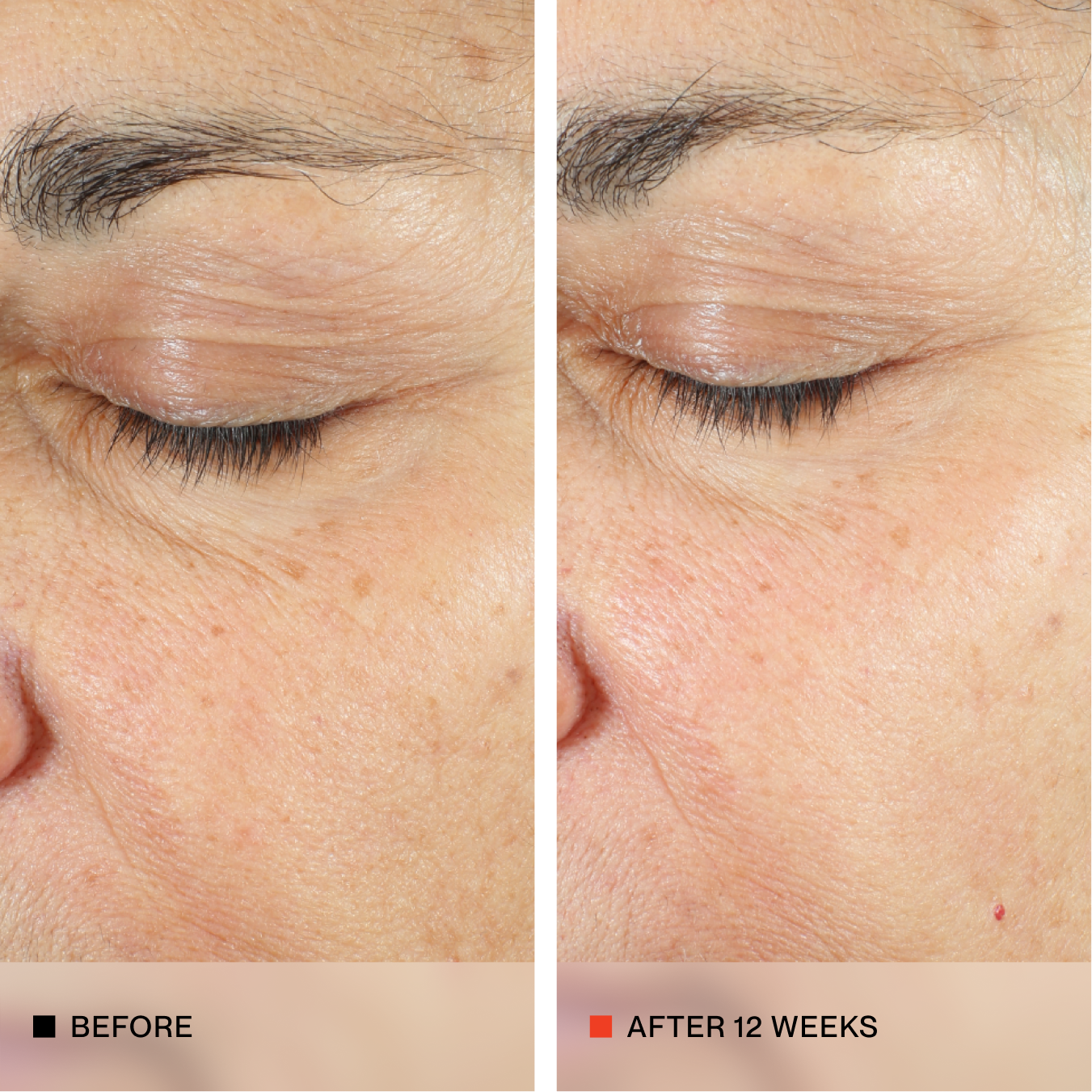 A side-by-side close-up comparison of an older person's eye and surrounding skin, labeled 'BEFORE' on the left and 'AFTER 12 WEEKS' on the right, showing visible skin improvement.