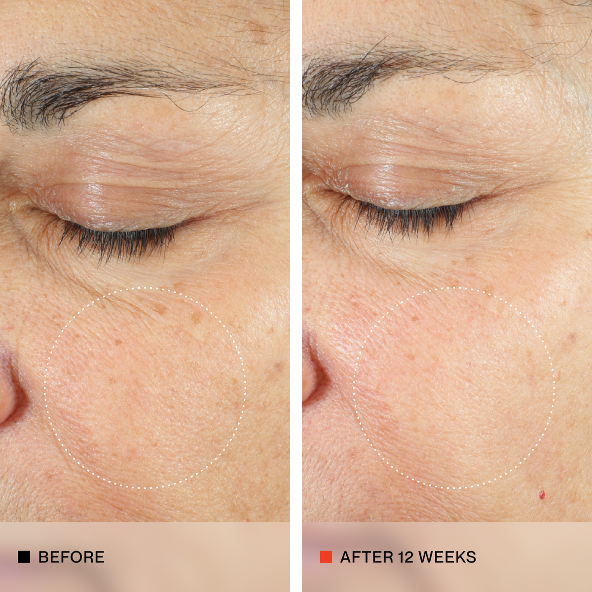 A side-by-side close-up comparison of an older person's eye and surrounding skin, labeled 'BEFORE' on the left and 'AFTER 12 WEEKS' on the right, showing visible skin improvement.