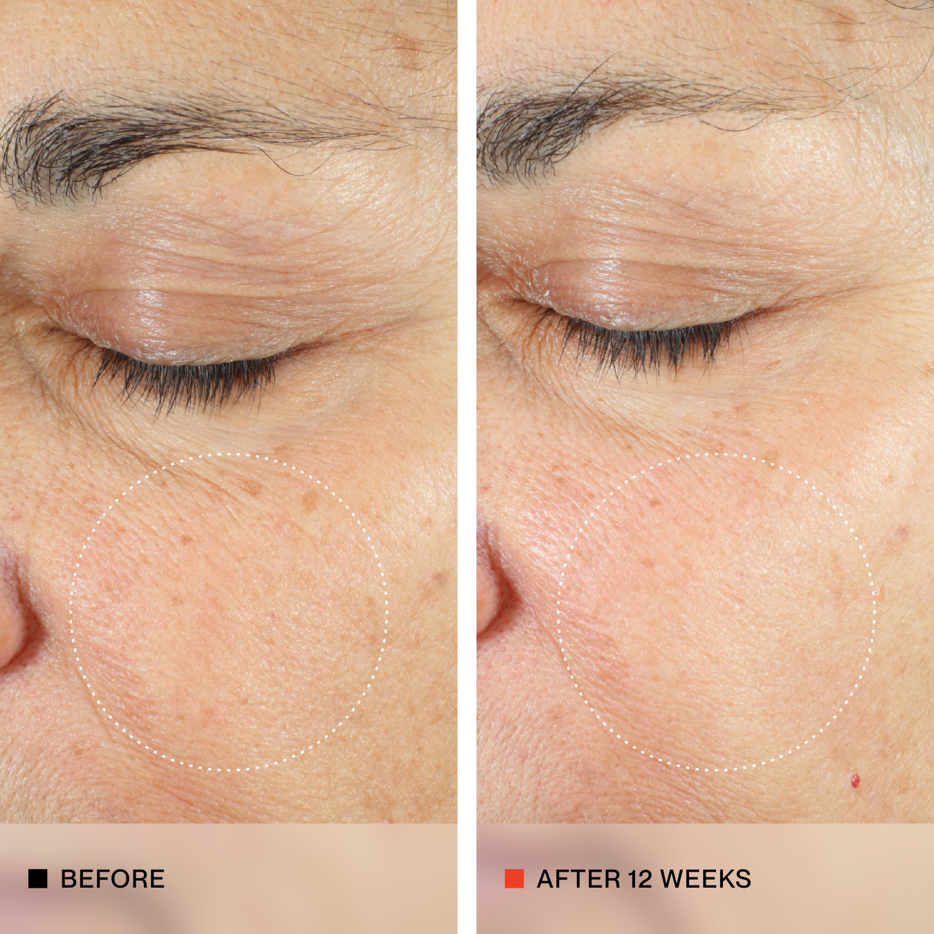 A side-by-side close-up comparison of an older person's eye and surrounding skin, labeled 'BEFORE' on the left and 'AFTER 12 WEEKS' on the right, showing visible skin improvement.