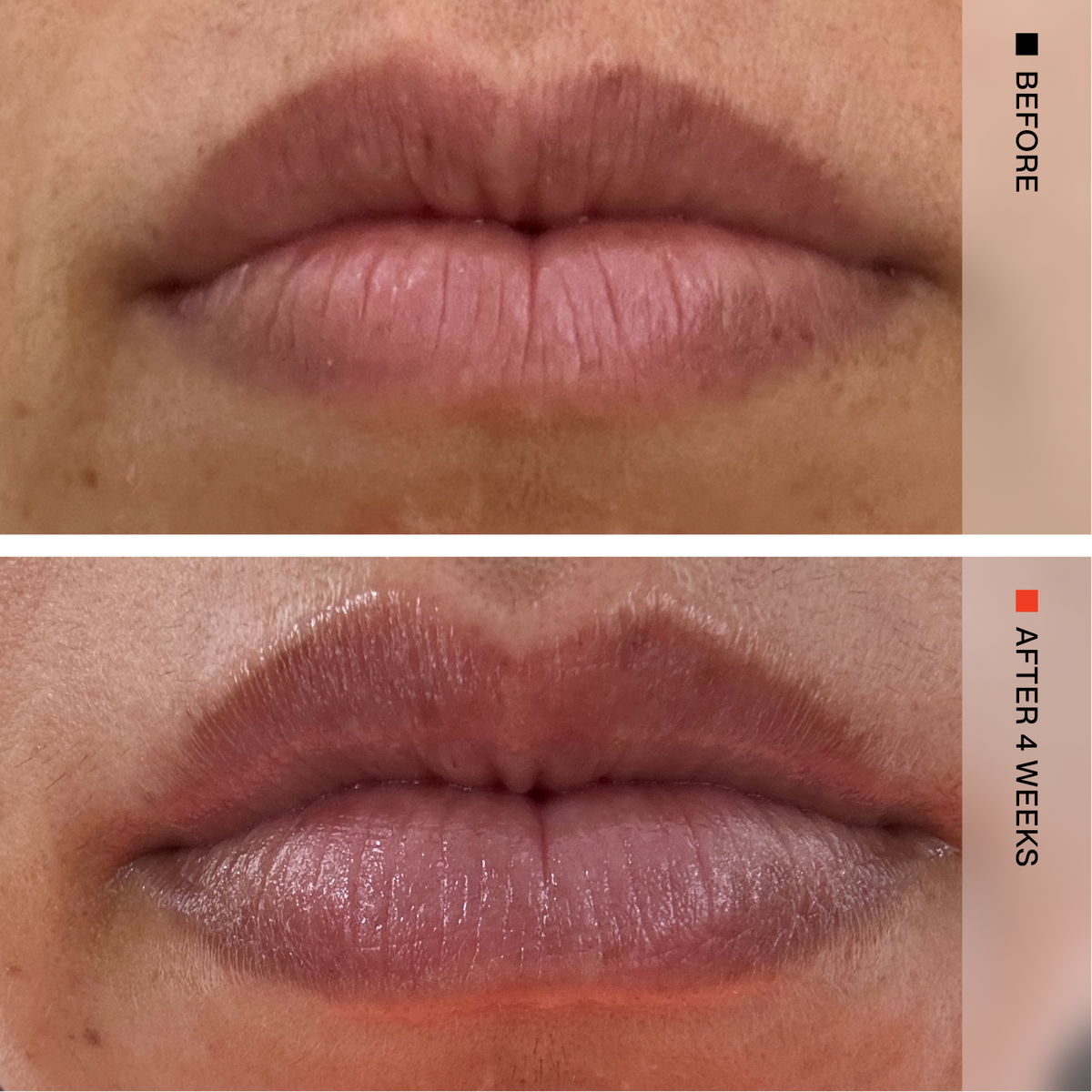Close-up before-and-after comparison of a person's lips, showing a matte pink lip color applied in the after photo after 4 weeks. The top panel is labeled BEFORE and shows natural, uncolored lips, while the bottom panel is labeled AFTER 4 WEEKS and shows the colored, hydrated lips.