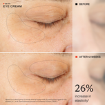 Before-and-after comparison of an eye cream treatment on a person's eye area, showing skin texture and elasticity improvement over 12 weeks. The top panel is labeled 'BEFORE' and the bottom panel 'AFTER 12 WEEKS' with text stating '26% increase in elasticity'.