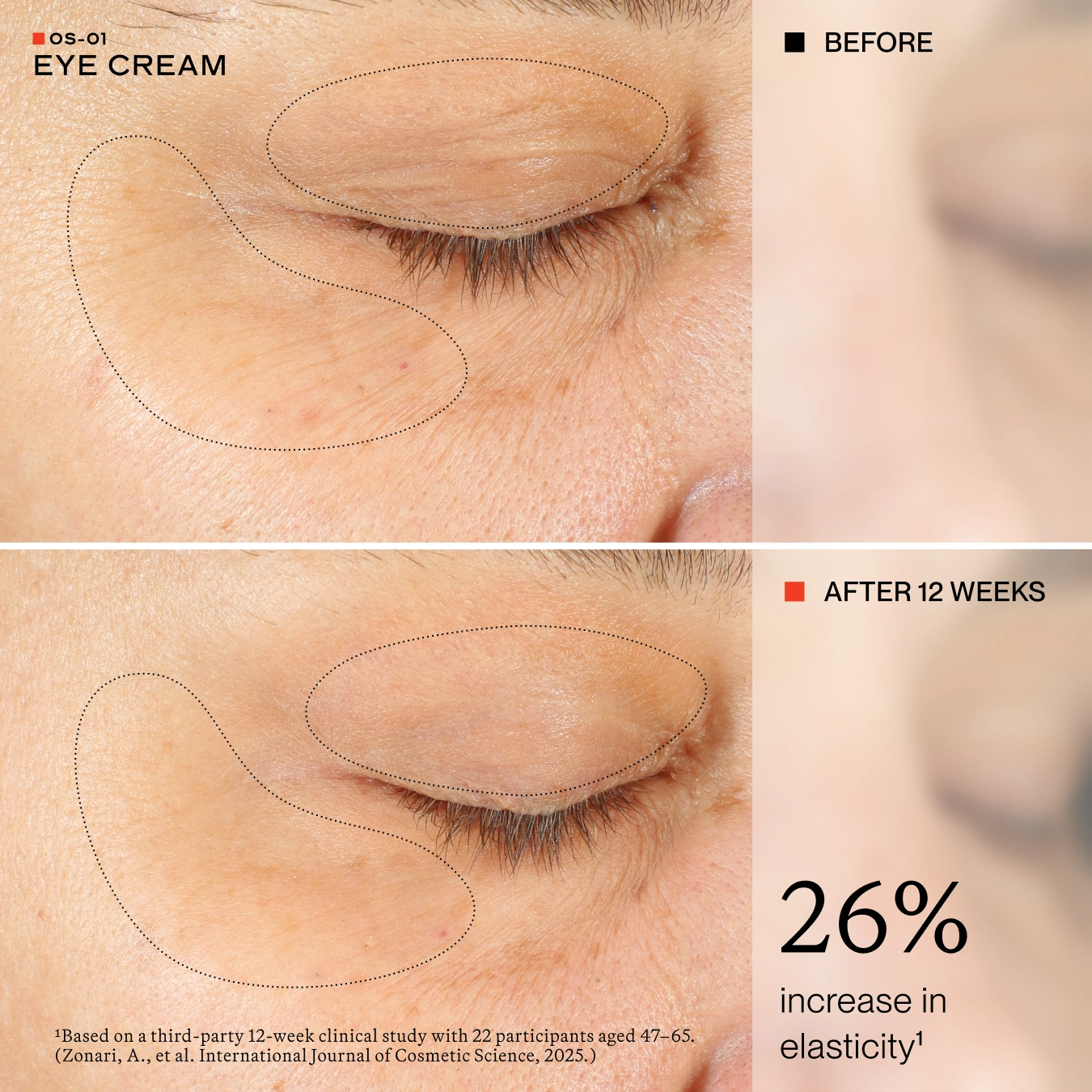 Before-and-after comparison of an eye cream treatment on a person's eye area, showing skin texture and elasticity improvement over 12 weeks. The top panel is labeled 'BEFORE' and the bottom panel 'AFTER 12 WEEKS' with text stating '26% increase in elasticity'.
