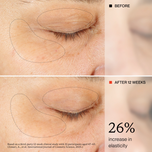 Before-and-after comparison of an eye area showing skin elasticity improvement over 12 weeks, with dotted outlines highlighting the treated region and text stating '26% increase in elasticity'.