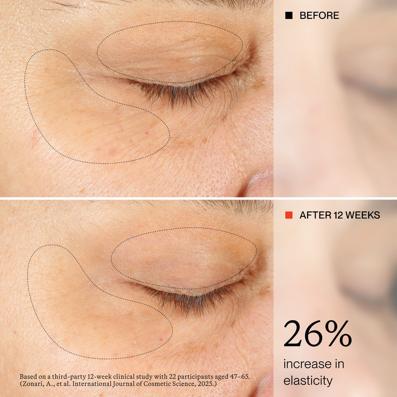 Before-and-after comparison of an eye area showing skin elasticity improvement over 12 weeks, with dotted outlines highlighting the treated region and text stating '26% increase in elasticity'.