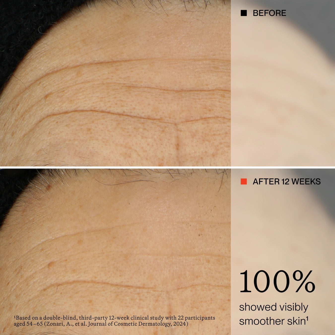 Before-and-after skin texture comparison on a human forehead, showing wrinkle reduction over 12 weeks, with text reading 'BEFORE,' 'AFTER 12 WEEKS,' and '100% showed visibly smoother skin.'.