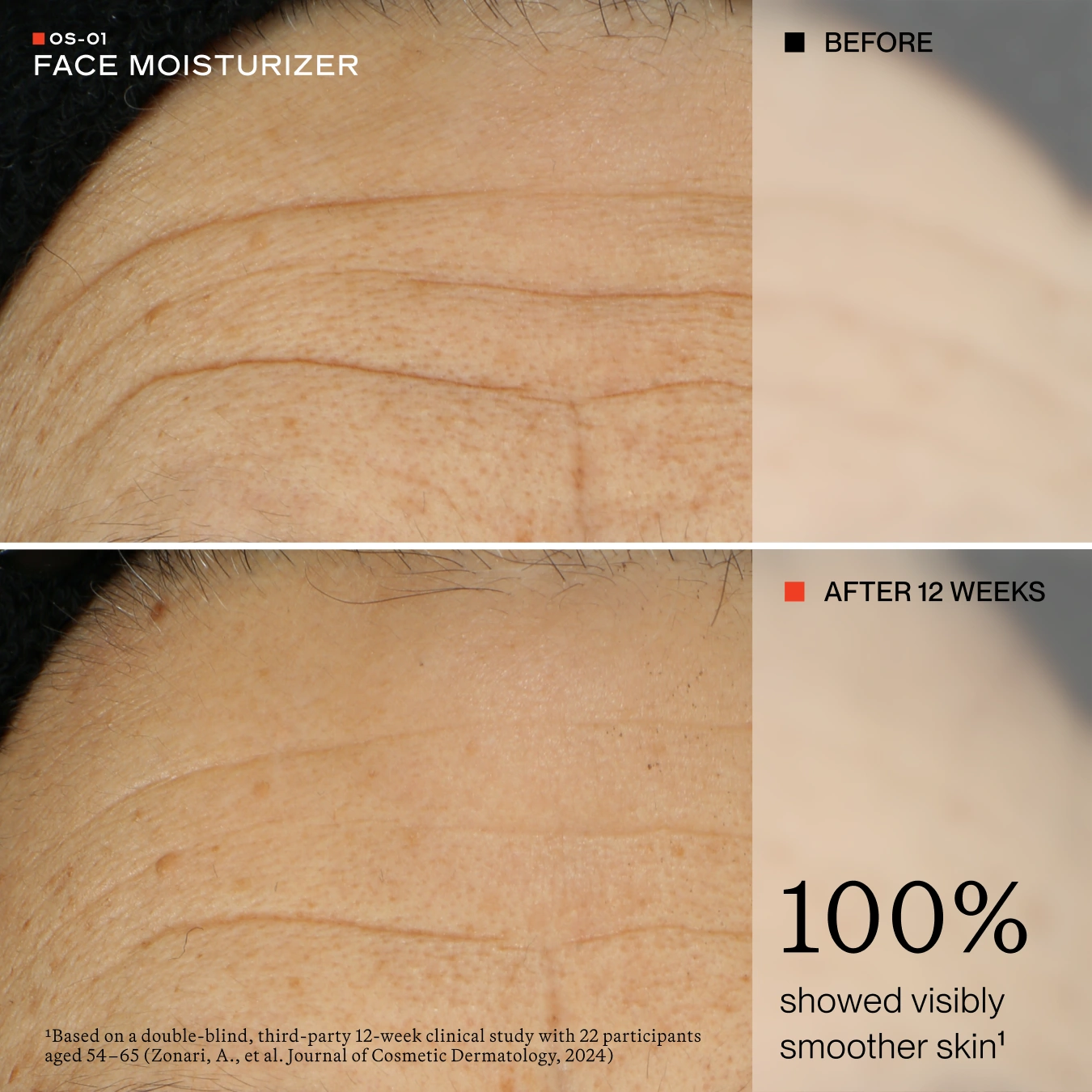 Before-and-after comparison of facial skin texture on the forehead, showing deep wrinkles and hyperpigmentation in the top panel labeled BEFORE, and smoother, clearer skin in the bottom panel labeled AFTER 12 WEEKS. Text on the right states '100% showed visibly smoother skin'.