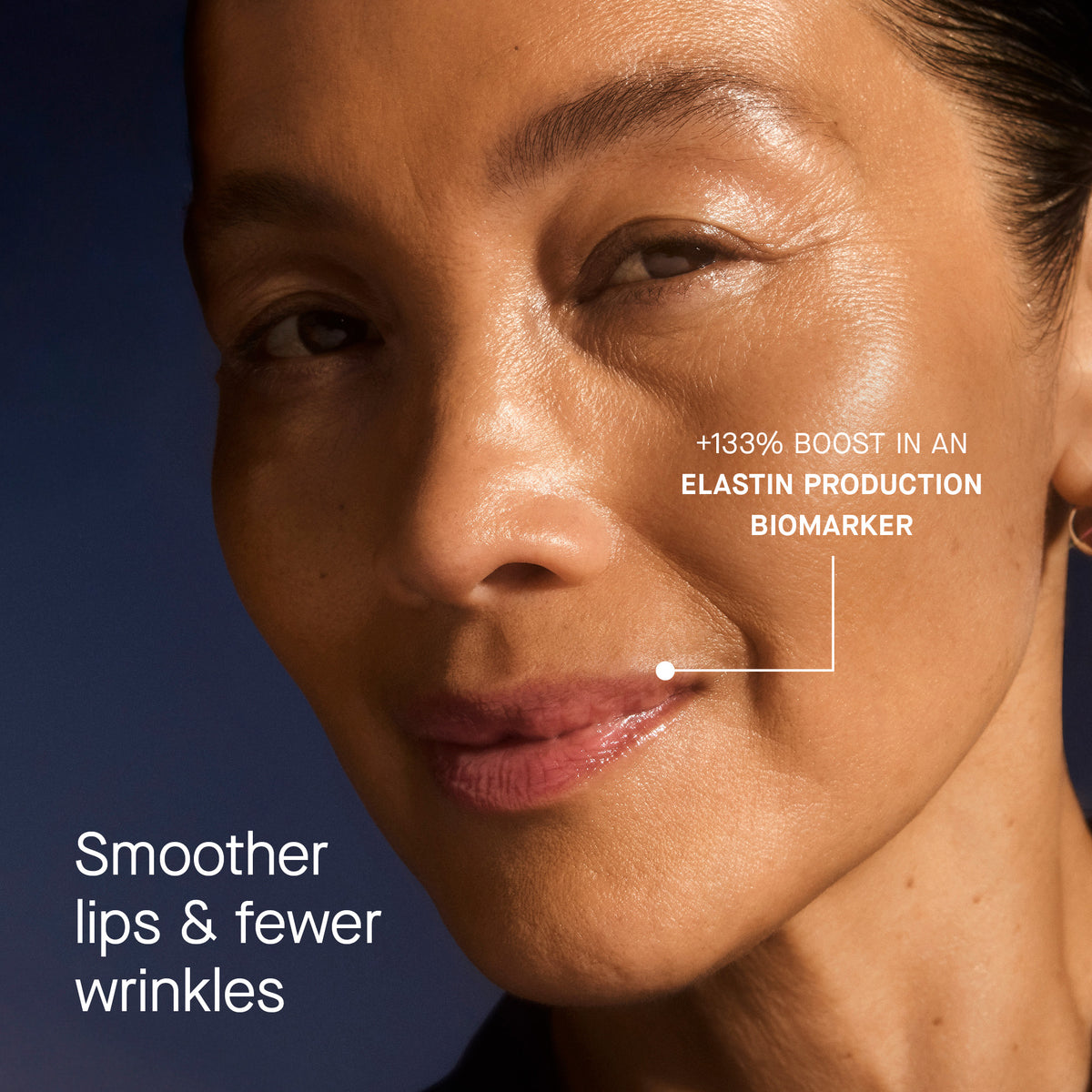OS-01 LIP Mask, Recurring