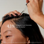 Close-up of a person applying OS-01 HAIR SCALP SERUM, with a hand holding a glass dropper above the scalp and text reading '43% increase in hair thickness after 6 months'.
