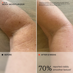 Before-and-after comparison of skin texture on an arm, labeled 'BODY MOISTURIZER' with 'BEFORE' on the left and 'AFTER 12 WEEKS' on the right, showing visibly smoother texture.