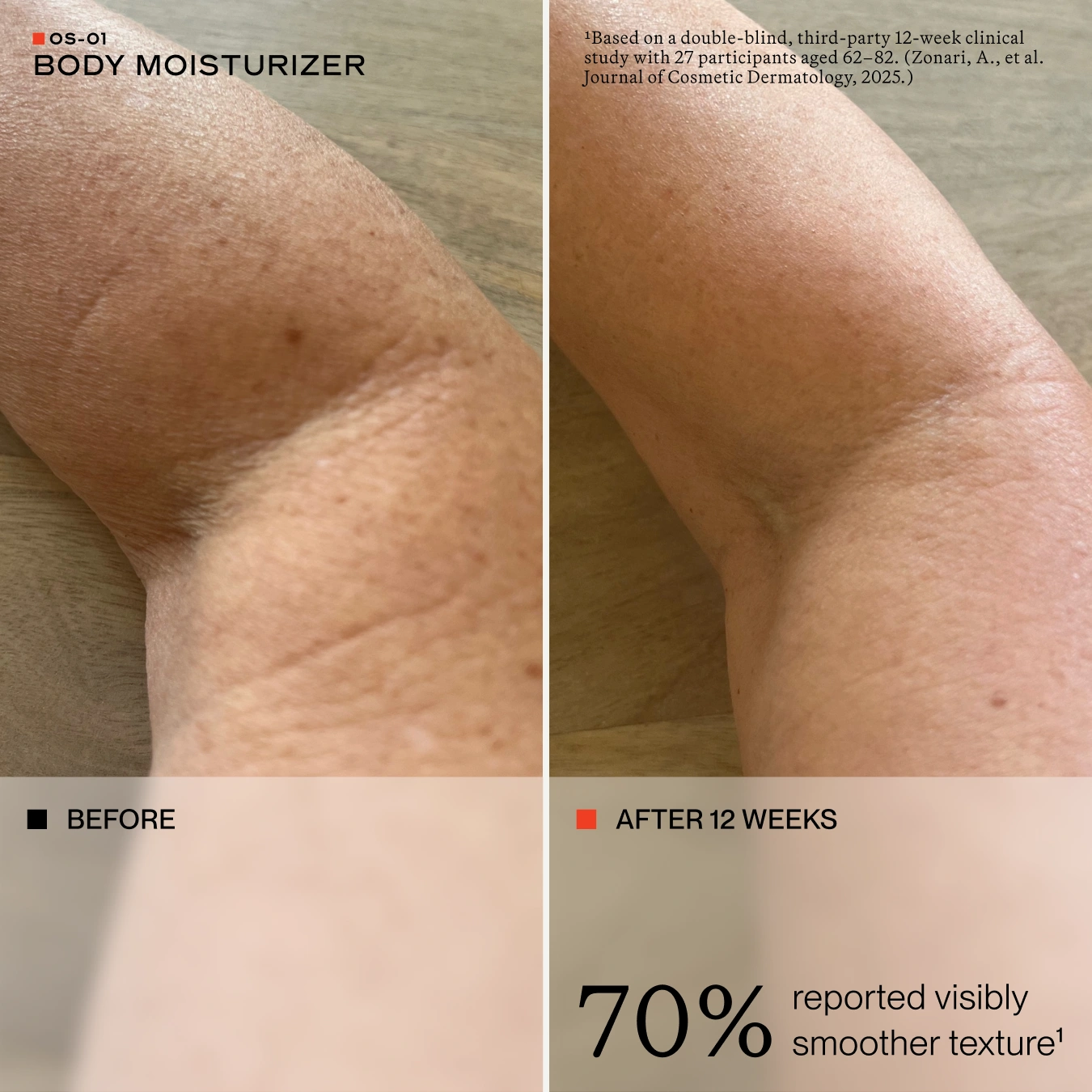 Before-and-after comparison of skin texture on an arm, labeled 'BODY MOISTURIZER' with 'BEFORE' on the left and 'AFTER 12 WEEKS' on the right, showing visibly smoother texture.