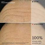 Before-and-after comparison of facial skin texture on the forehead, showing deep wrinkles and hyperpigmentation in the top panel labeled BEFORE, and smoother, clearer skin in the bottom panel labeled AFTER 12 WEEKS. Text on the right states '100% showed visibly smoother skin'.