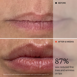 Before-and-after comparison of lips showing reduced fine lines and wrinkles after 12 weeks. The top panel is labeled BEFORE and shows dry, creased lips; the bottom panel is labeled AFTER 12 WEEKS and shows smoother, shinier lips.