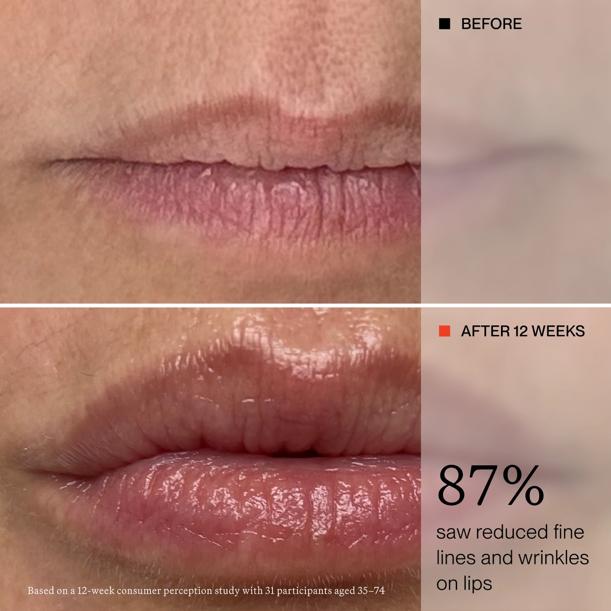 Before-and-after comparison of lips showing reduced fine lines and wrinkles after 12 weeks. The top panel is labeled BEFORE and shows dry, creased lips; the bottom panel is labeled AFTER 12 WEEKS and shows smoother, shinier lips.