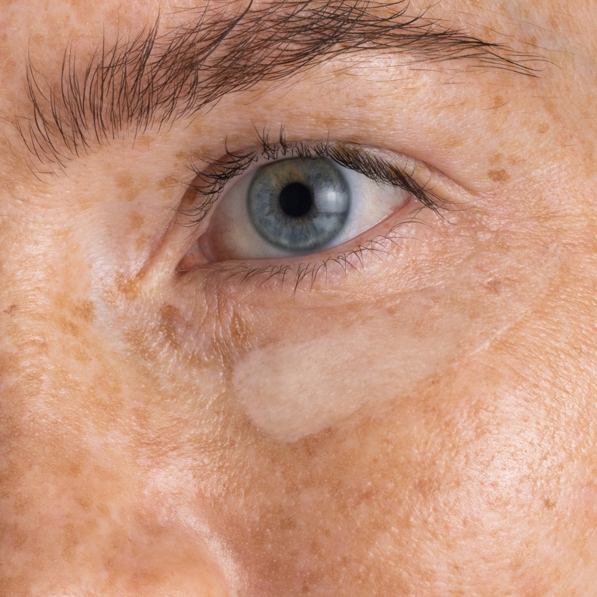 Close-up of a person's eye with visible skin texture