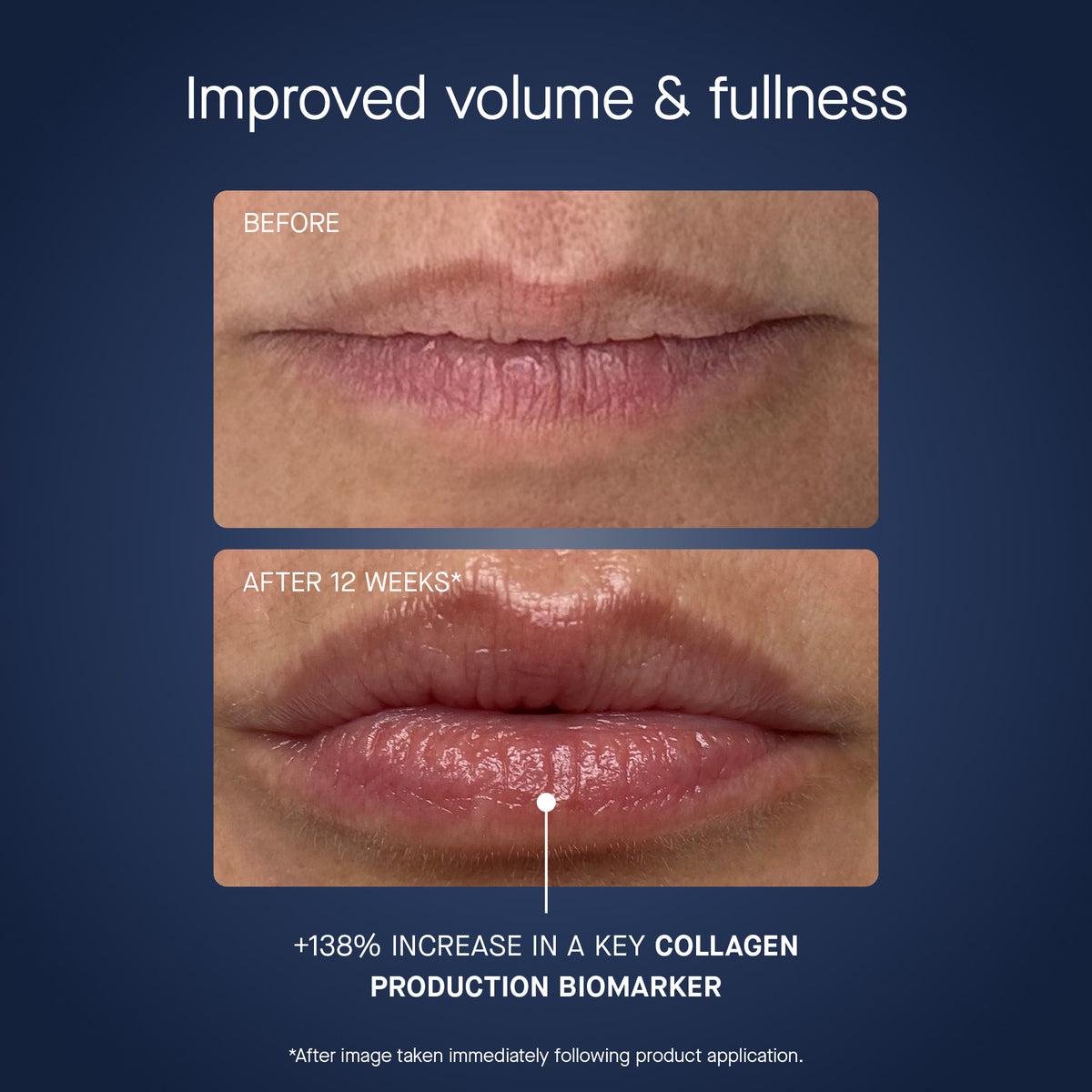 OS-01 LIP Mask, Recurring